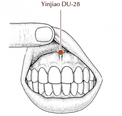 Inside the mouth, in the superior frenulum, at the junction of the upper lip and the gum.