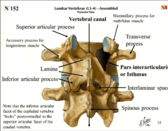 the orientation of the articular facets locking them in.
