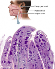 Which tonsil is located in the posterior wall of the nasopharynx and is referred to as the adenoids if it is enlarged?
A. palatine tonsils
B. tubal tonsils
C. pharyngeal tonsil
D. lingual tonsil