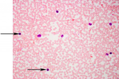 A. lymphocytes
B. eosinophils
C.neutrophils
D. basophils