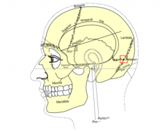 

n human anatomy, the asterion is a visible, so-called craniometric, point on the exposed skull, just behind the ear, where three cranial suturesmeet:the lambdoid,parieto-mastoid, andoccipito-mastoid sutures,