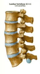 this is where most disc herniations occur due to pressure, so it's good that there is a spacious separation between spinal root and disc