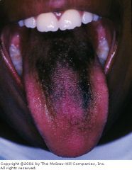 What did this patient likely ingest?