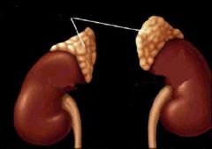 Endocrine glands located on top of the kidneys that release adrenaline when stimulated by the sympathetic nervous system.