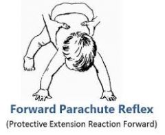 See image.
The other name for the Forward Parachute Reflex is the Protective Extension Reaction Forward.