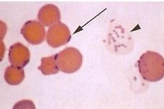Mycoplasma spp.