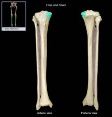 medial rounded articular projection at proximal epiphysis of the bone