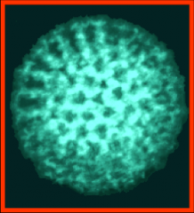 Identify and describe this virus