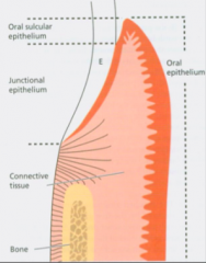 1) Gingival oral epithelium
2) Gingival sulculuar epithelium
3) Gingival junctional epithelium