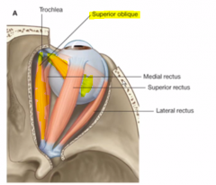 1. parralell to the medial rectus
2. threaded through troclea
3. attached to back of eye past the superior rectus

Inferior oblique- the same medial course except it attaches underneath the eye