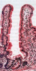 What does this slide show? Which part of the GI tract is it characteristic of?