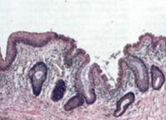What does this slide show? Which part of the GI tract is it characteristic of?
