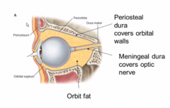 periosteal dura lines the pyrimid that is the orbit of the eye while the meningeal dural travels along with it on the sclera.

Fat fills in space between the dura the same as epidural fat in the spinal column