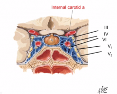 the cavernous sinus

a lot of sensitive stuff is there. (All the eye cranial nerves, V1 and 2, pituitary gland, and internal carotid artery)
