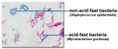 

acid fast is pink 
shapes: cocci or bacillus
