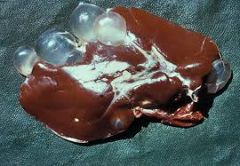 You look at a sheep liver and find all these grim balloon like pedunculated structures. What parasite is the likely cause of these? Judgement?