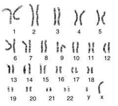 What do you call the picture of the chromosomes shown?