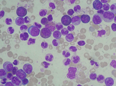 Promyelocytes
- Big cells and big nuclei
- Coarse grains in cytoplasm
- Basophilic