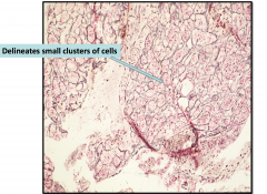 Anterior Pituitary Gland Architecture (reticulin stain)