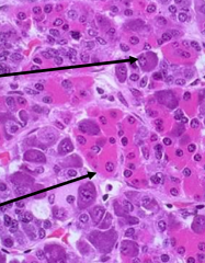 - Top arrow: basophil (bluer)
- Bottom arrow: acidophil (pinker)