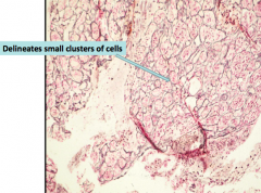 Normal anterior pituitary gland architecture (reticulin stain)