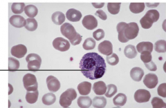 A. lymphocyte
B. erythrocyte
C. neutrophil
D. eosinophil