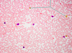 A. monocytes
B. neutrophils
C. lymphocytes
D. eosinophils