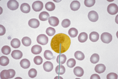 A. lymphocyte
B. neutrophil
C. basophil
D. monocyte