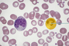 A. platelet
B. lymphocyte
C. neutrophil
D. monocyte