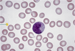 A. erythrocyte
B. monocyte
C. platelet
D. leukocyte