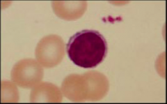 A. Hemoglobin 
B. Hemotopoieses 
C. Sickled red blood cell D. Lymphocyte 
E. Neutrophil 
F. Red blood cell 
G. Type A blood 
H. Monocyte 
I. Basophil