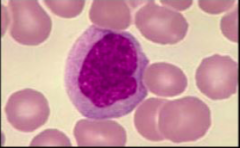 A. Hemoglobin 
B. Hemotopoieses 
C. Sickled red blood cell
D. Lymphocyte 
E. Neutrophil 
F. Red blood cell 
G. Type A blood
H. Monocyte 
I. Basophil