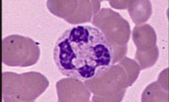 A. Hemoglobin 
B. Hemotopoieses 
C. Sickled red blood cell
D. Lymphocyte 
E. Neutrophil 
F. Red blood cell 
G. Type A blood 
H. Monocyte 
I. Basophil