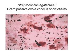 Steptococcus agalactiae
Group B