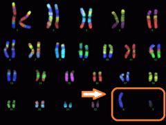  
 

A pair of chromosomes which specify gender and determine whether you are male or female. The sex chromosomes are labeled X and Y.