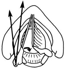 A: Observation
A: Voice therapy
A: Injection techniques (percutaneous, transoral,laryngoscopically)
A: Type I Isshiki thyroplasty (medialization thyroplasty)
A: Type I Isshiki + Arytenoid adductionA: Laryngeal reinnervation (ansa cervicalis transf...