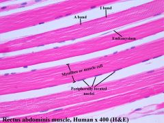 Long string with multiple nuclei on the outside of the fiber


 


Myofibrils - Long strands of proteins (the actin and myosin)


 


Myofilaments - one strand of myofibril


 


Sarcomere - one segment of a myofilament. Extends...