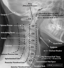Adequacy (T1)Lines:
1. Anterior 

vertebral 
2. Posterior vertebral 
3. Spinolaminal line, 
4. SP line   

Soft tissues,
       retropharyngeal space:            
General
rule – above C4 < ½ vertebral body; below C4 1 vertebral body
