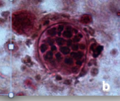 Arthroconidia
develop into spherules
containing endospores.







Coccidioides = Valley Fever.   