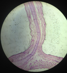 What Tissue is this?
