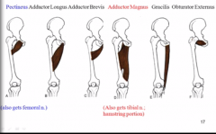 the ones that are higher up and shorter get femoral
the ones lower down get tibial