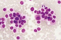 Thyroid FNA

syndromes?