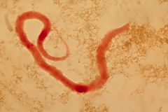 Dirofilaria
Dog heartworm / tapeworm