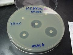Double disk test

(Organism will be resistant to cephalosporin, but SUSCEPTIBLE to cephalosporin PLUS clavulinic acid
