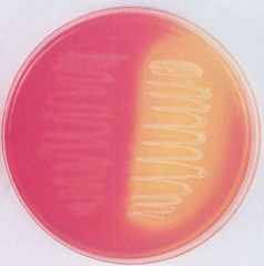 Mannitol salt agar. What ferments mannitol and turns it yellow?