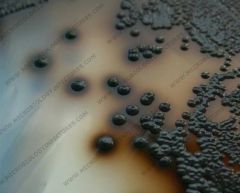 Cysteine tellurite agar
Black colonies with brown halo