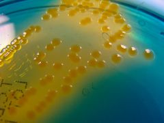TCBS agar. turns yellow due to sucrose fermentation of?