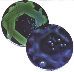 GNB
Glucose nonfermenter
Oxidase +
Mucoid
Fluorescent green & blue pigment (pyocyanin)
GROWTH AT 42C
Grapey odor