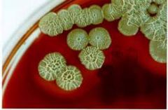 Dry yellow colonies
GNB
Oxidase -
Glucose nonfermenter
CF pathogen