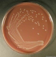 Microaerophile
gram neg coccobacillus
20% resistant to ampicillin by beta-lactamase